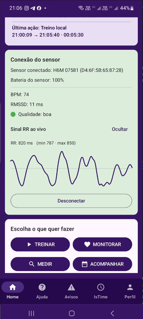 Exemplo de conexão de sensor: Visualização do sinal cardíaco ao vivo no BreathHRV